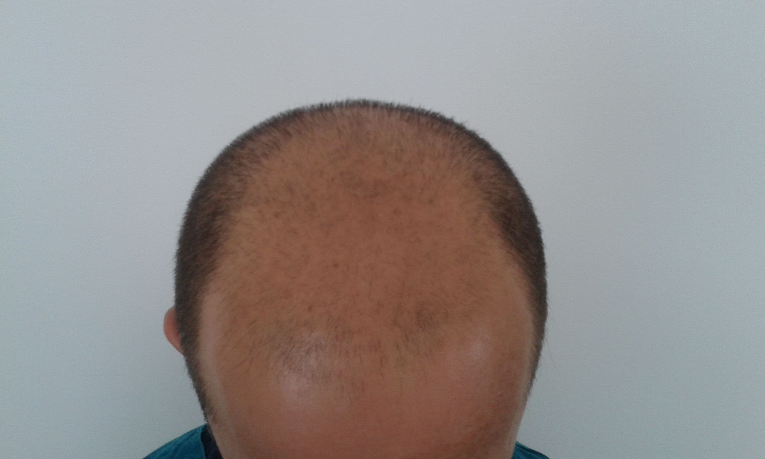 Additional image 1 - Patient 4