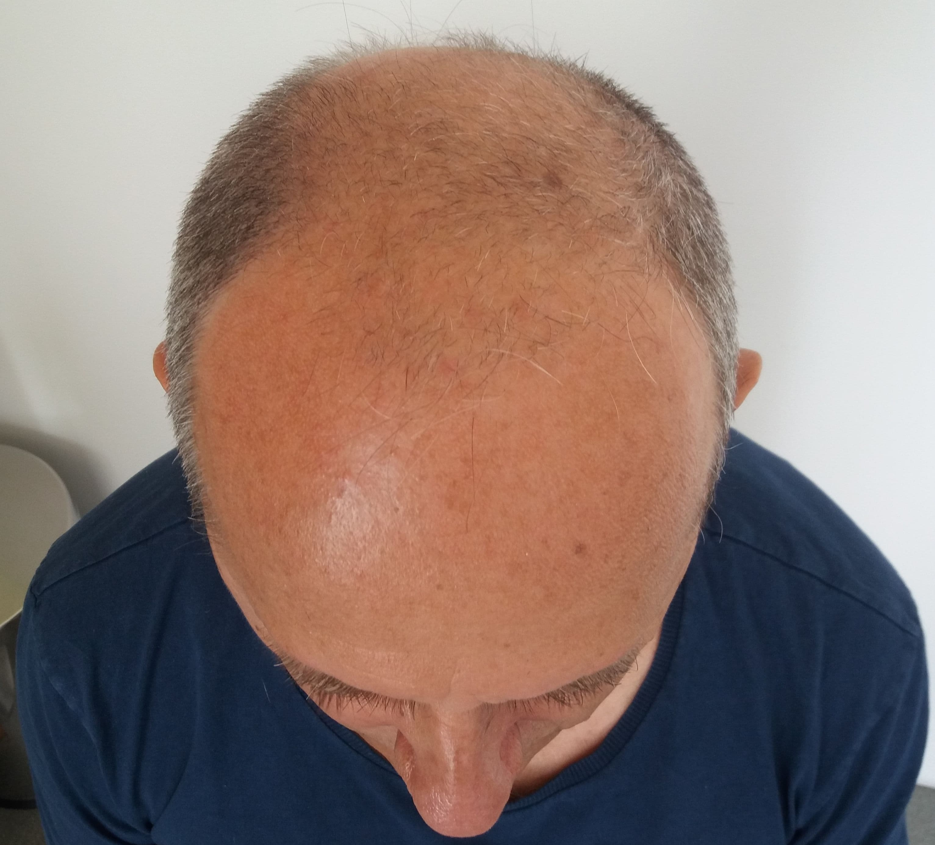 Additional image 1 - Patient 3