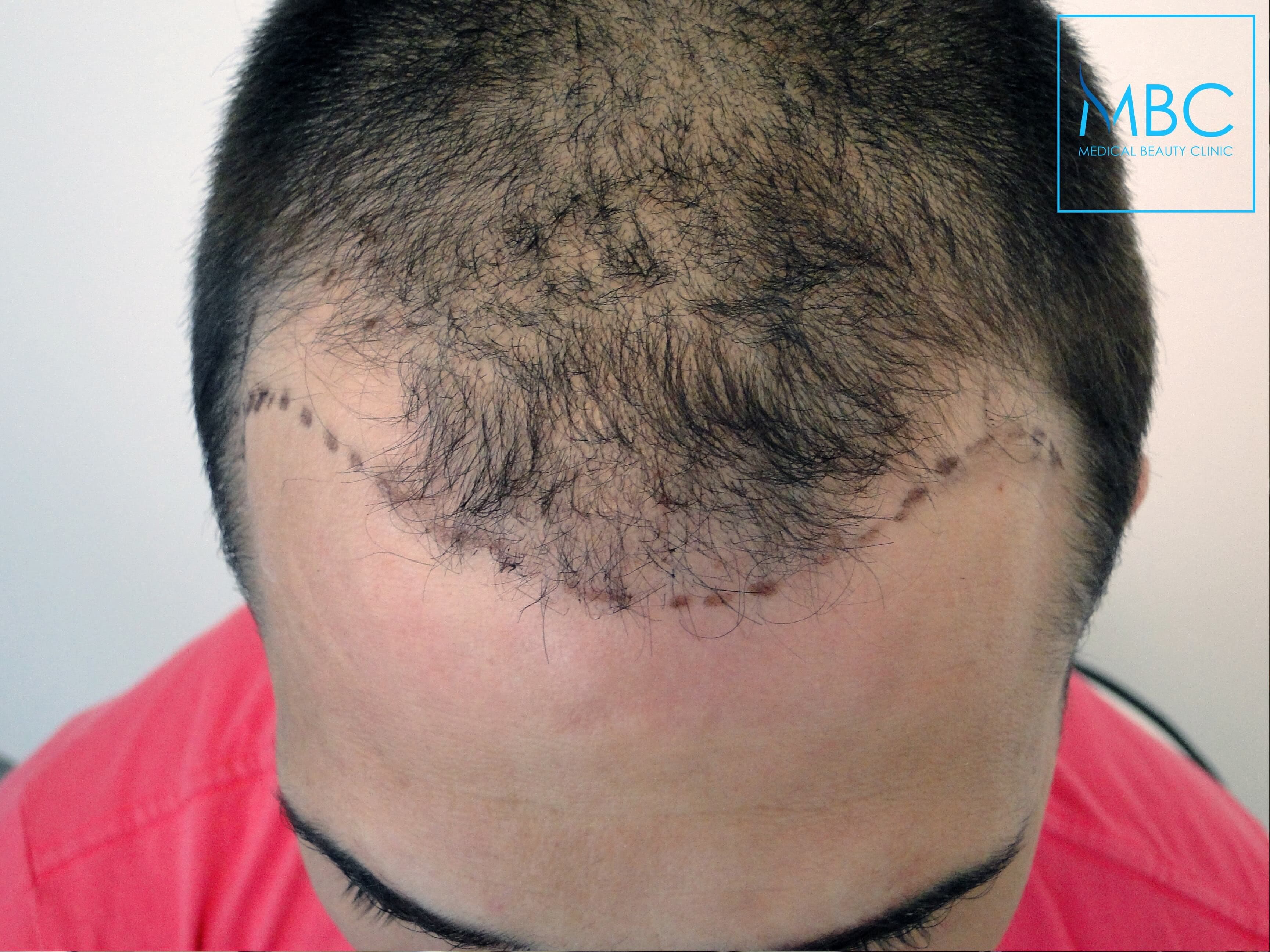 Additional image 1 - Patient 1