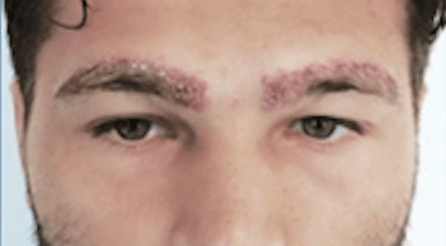 Additional image 1 - Patient 6