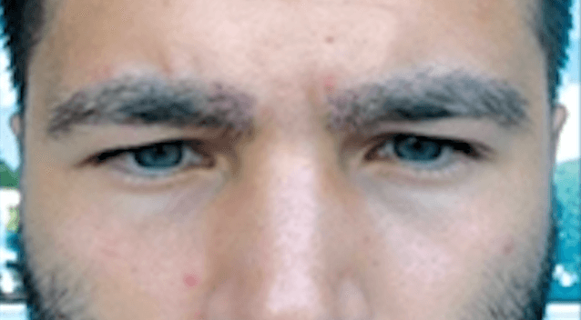 Additional image 2 - Patient 6