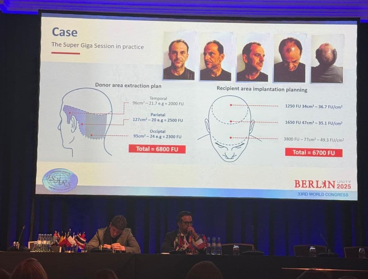 Marija Balkovic ISHRS kongres u Berlinu