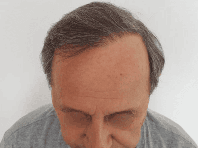 Additional image 2 - Patient 3