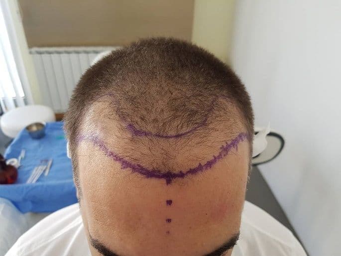 Additional image 1 - Patient 5