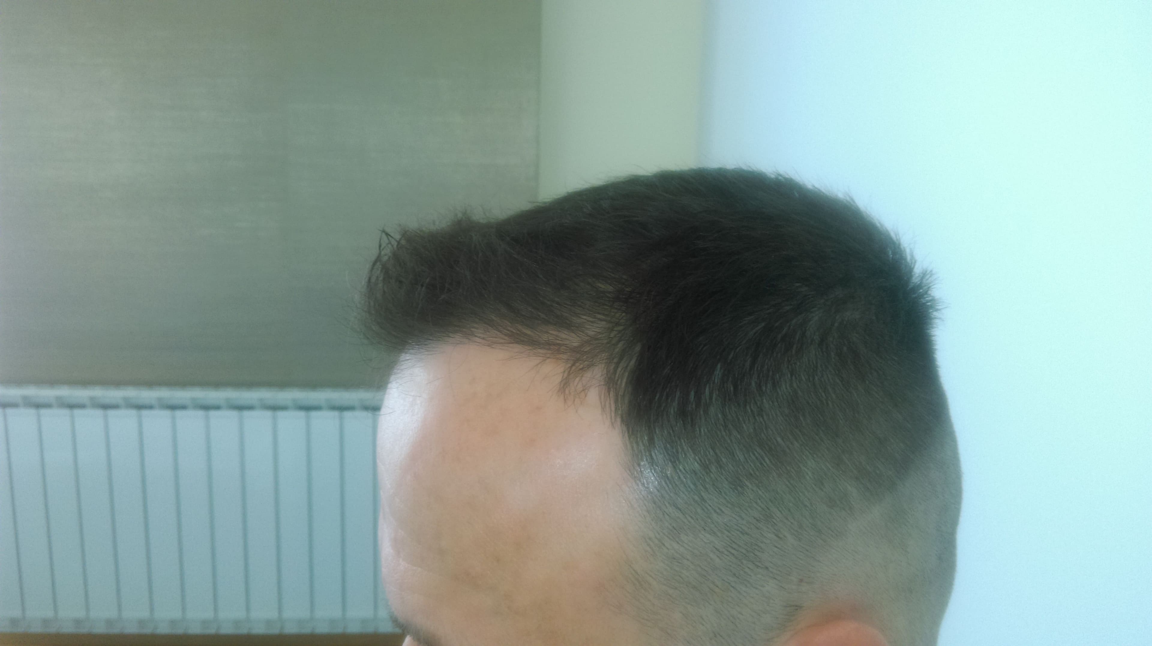 pacijent_3_additional_1