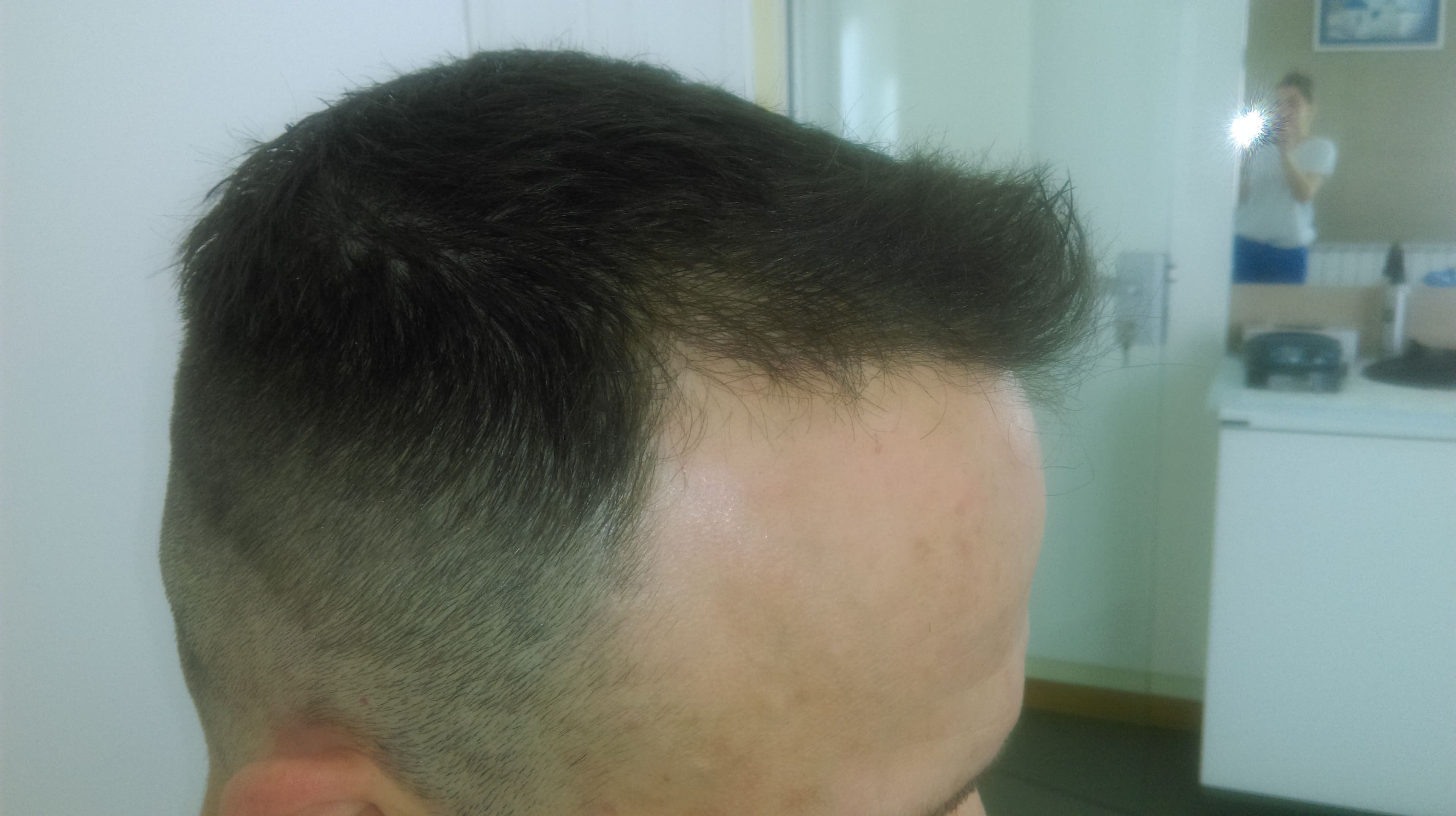 pacijent_3_additional_2