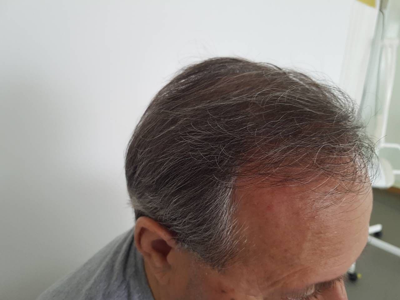 pacijent_2_additional_2