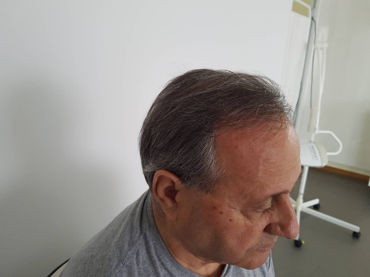 pacijent_2_additional_4