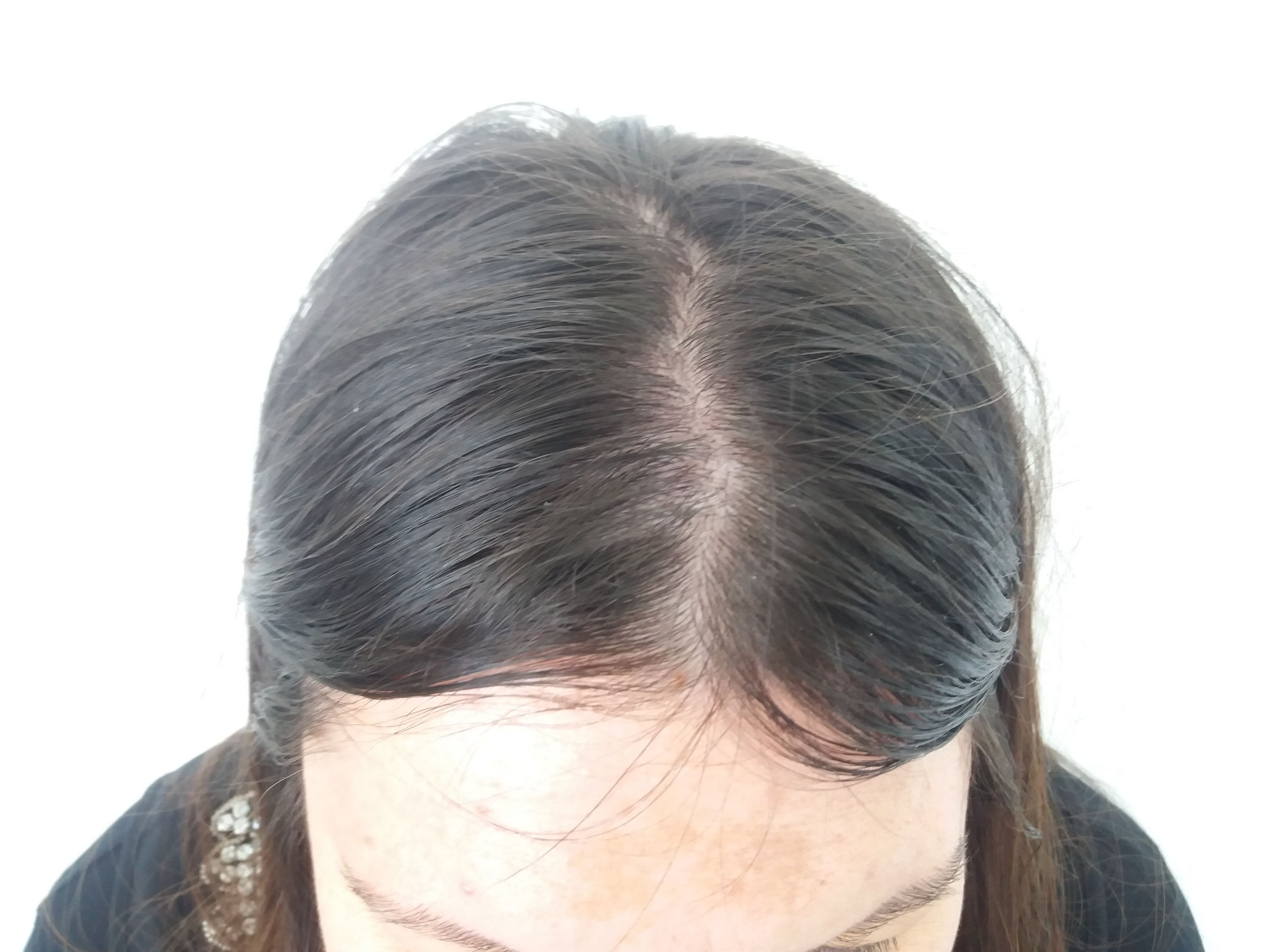 After treatment - Patient 3