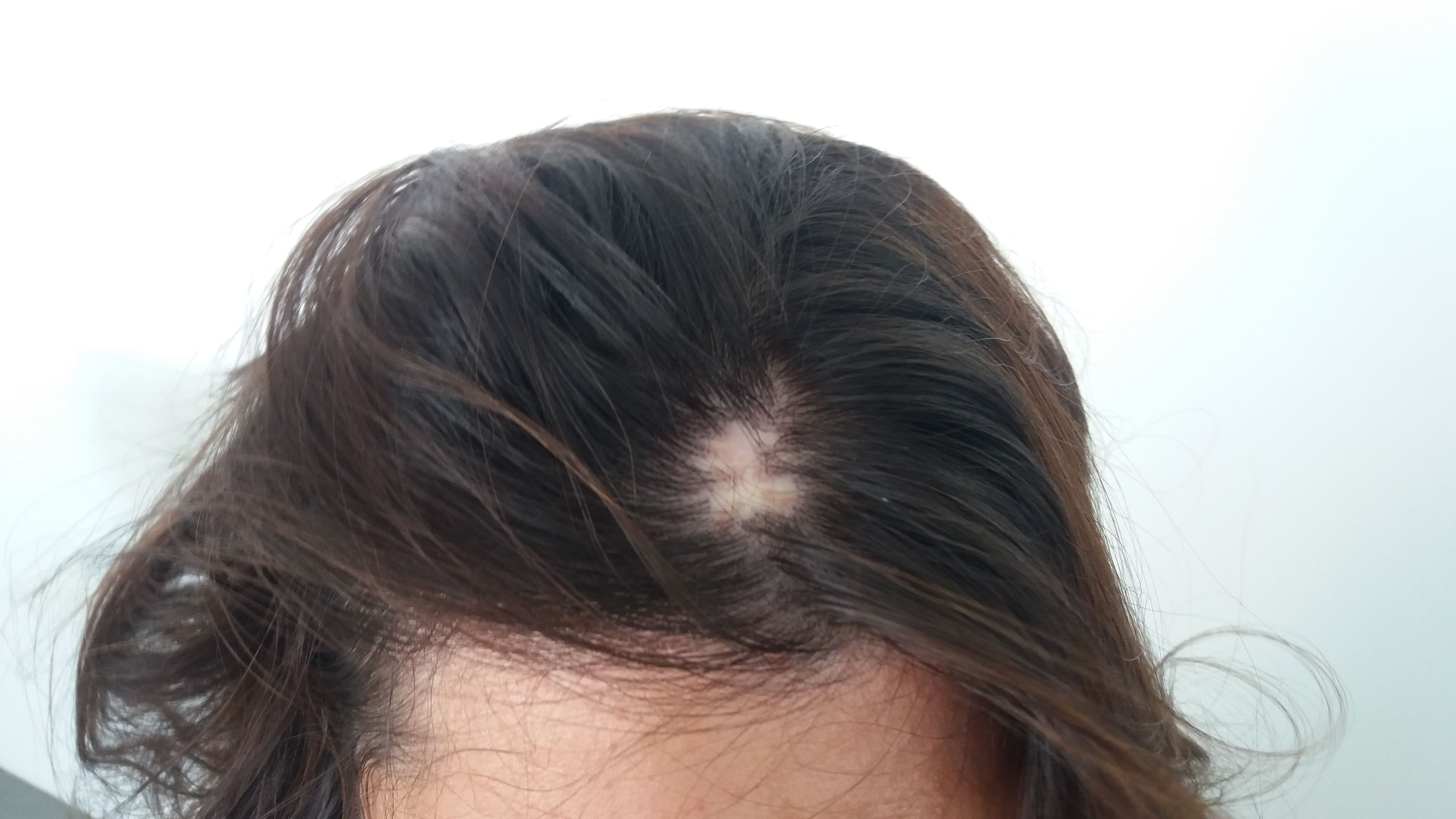 Before treatment - Patient 3