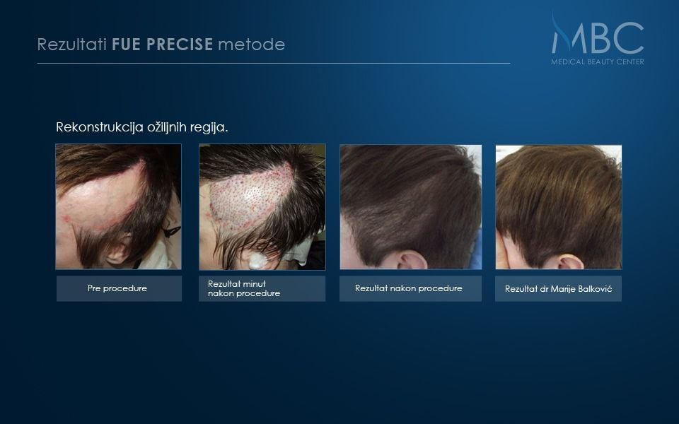 pre-i-posle-slika