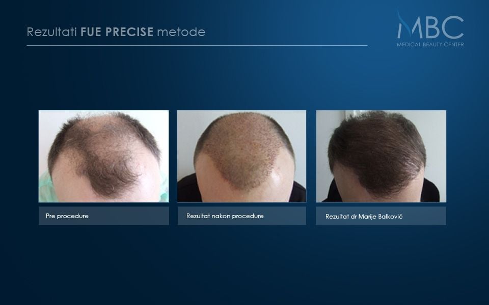 pre-i-posle-slika