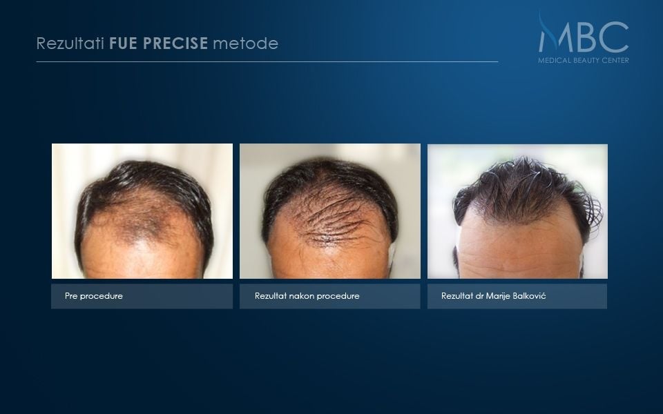 pre-i-posle-slika