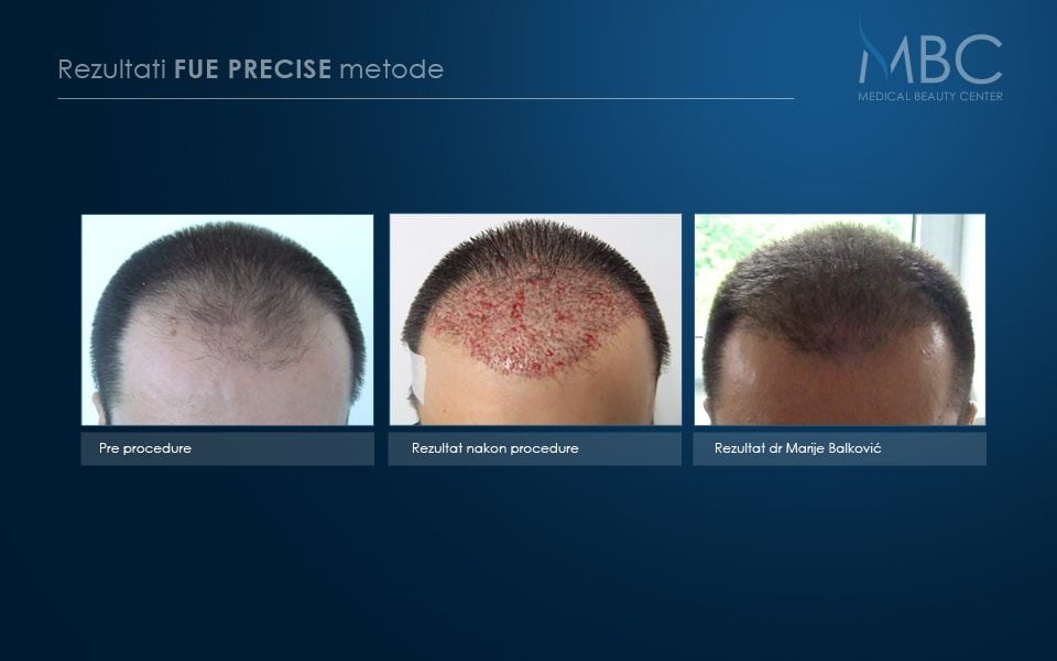 pre-i-posle-slika