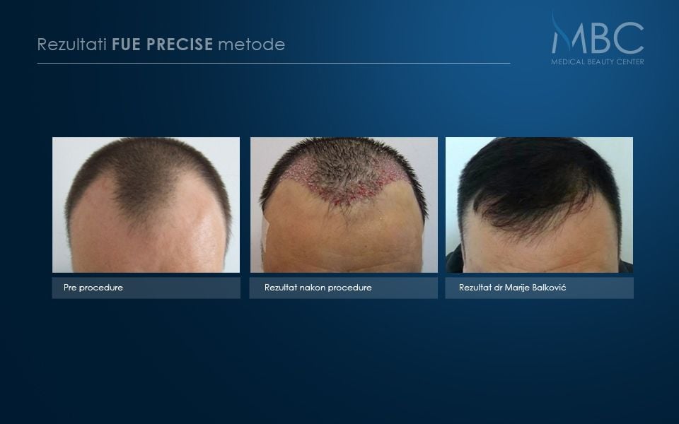 pre-i-posle-slika