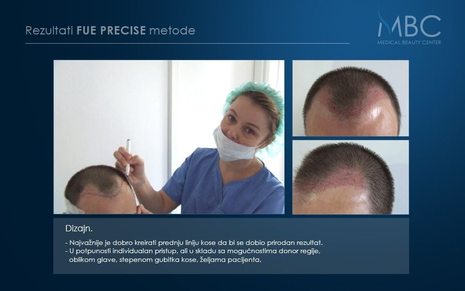 pre-i-posle-slika