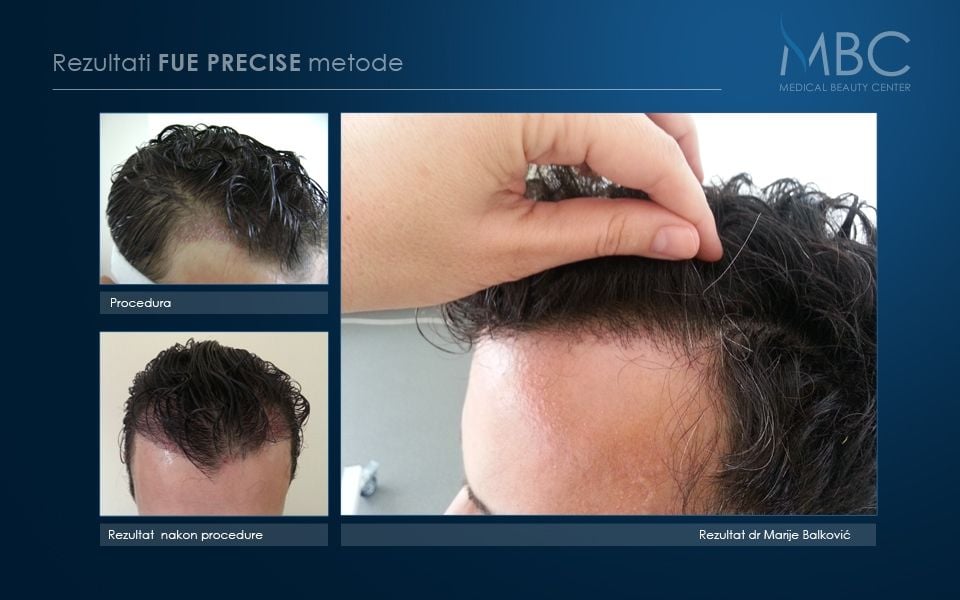 pre-i-posle-slika