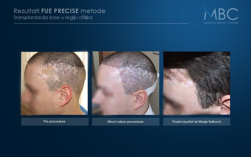 pre-i-posle-slika