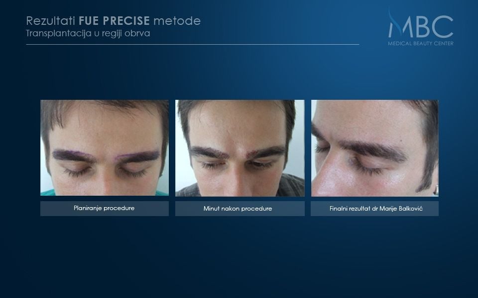 pre-i-posle-slika