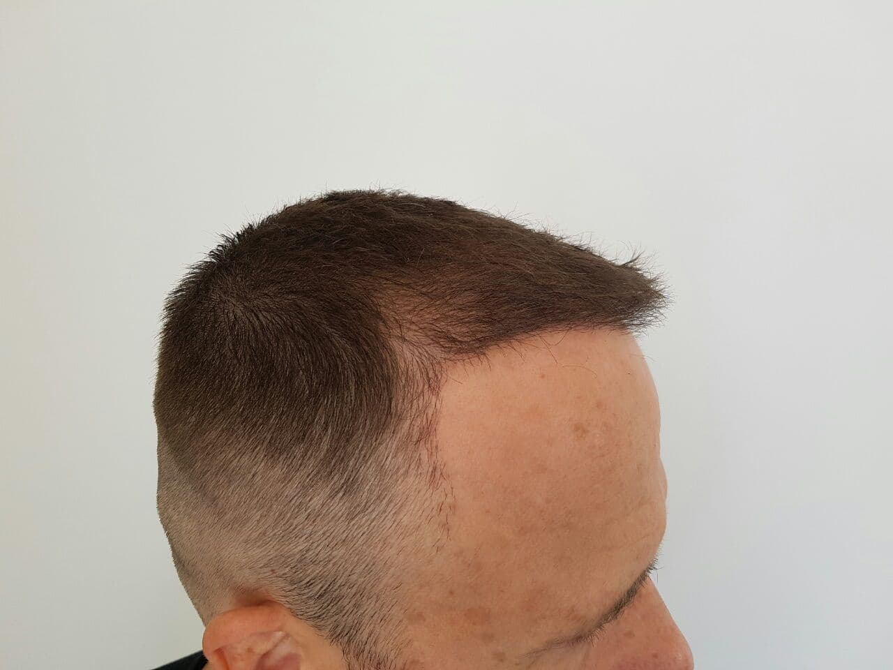 pacijent_3_additional_3